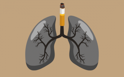 Arrêter de fumer naturellement grâce à la luxopuncture